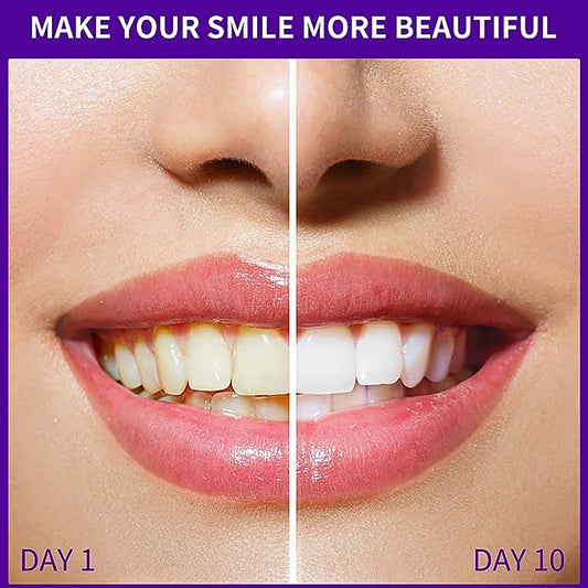 GlorySmile v34 Color Correction Toothpaste